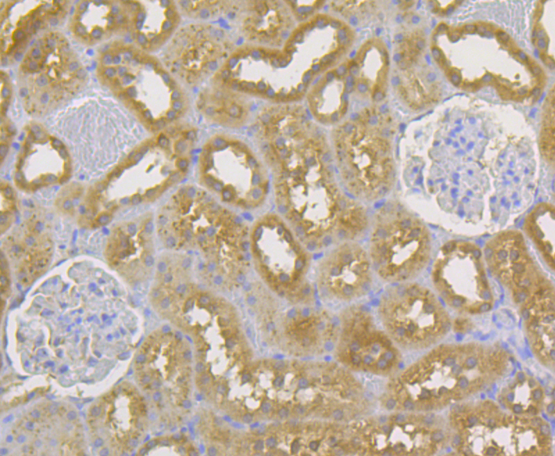 Immunohistochemical analysis of paraffin-embedded rat kidney tissue using anti-CD99 antibody. The section was pre-treated using heat mediated antigen retrieval with Tris-EDTA buffer (pH 8.0-8.4) for 20 minutes.The tissues were blocked in 5% BSA for 30 minutes at room temperature, washed with ddH2O and PBS, and then probed with the antibody (ER1803-81) at 1/50 dilution, for 30 minutes at room temperature and detected using an HRP conjugated compact polymer system. DAB was used as the Chromogen. Counter stained with hematoxylin and mounted with DPX.