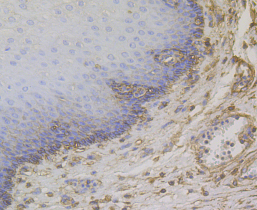 Immunohistochemical analysis of paraffin-embedded human esophagus tissue using anti-CD99 antibody. The section was pre-treated using heat mediated antigen retrieval with Tris-EDTA buffer (pH 8.0-8.4) for 20 minutes.The tissues were blocked in 5% BSA for 30 minutes at room temperature, washed with ddH2O and PBS, and then probed with the antibody (ER1803-81) at 1/200 dilution, for 30 minutes at room temperature and detected using an HRP conjugated compact polymer system. DAB was used as the Chromogen. Counter stained with hematoxylin and mounted with DPX.