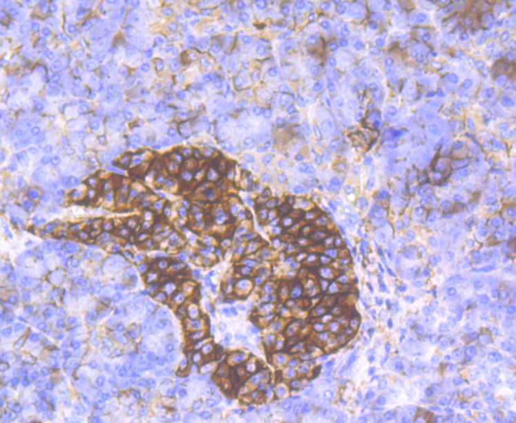 Immunohistochemical analysis of paraffin-embedded human pancreas tissue using anti-CD99 antibody. The section was pre-treated using heat mediated antigen retrieval with Tris-EDTA buffer (pH 8.0-8.4) for 20 minutes.The tissues were blocked in 5% BSA for 30 minutes at room temperature, washed with ddH2O and PBS, and then probed with the antibody (ER1803-81) at 1/200 dilution, for 30 minutes at room temperature and detected using an HRP conjugated compact polymer system. DAB was used as the Chromogen. Counter stained with hematoxylin and mounted with DPX.