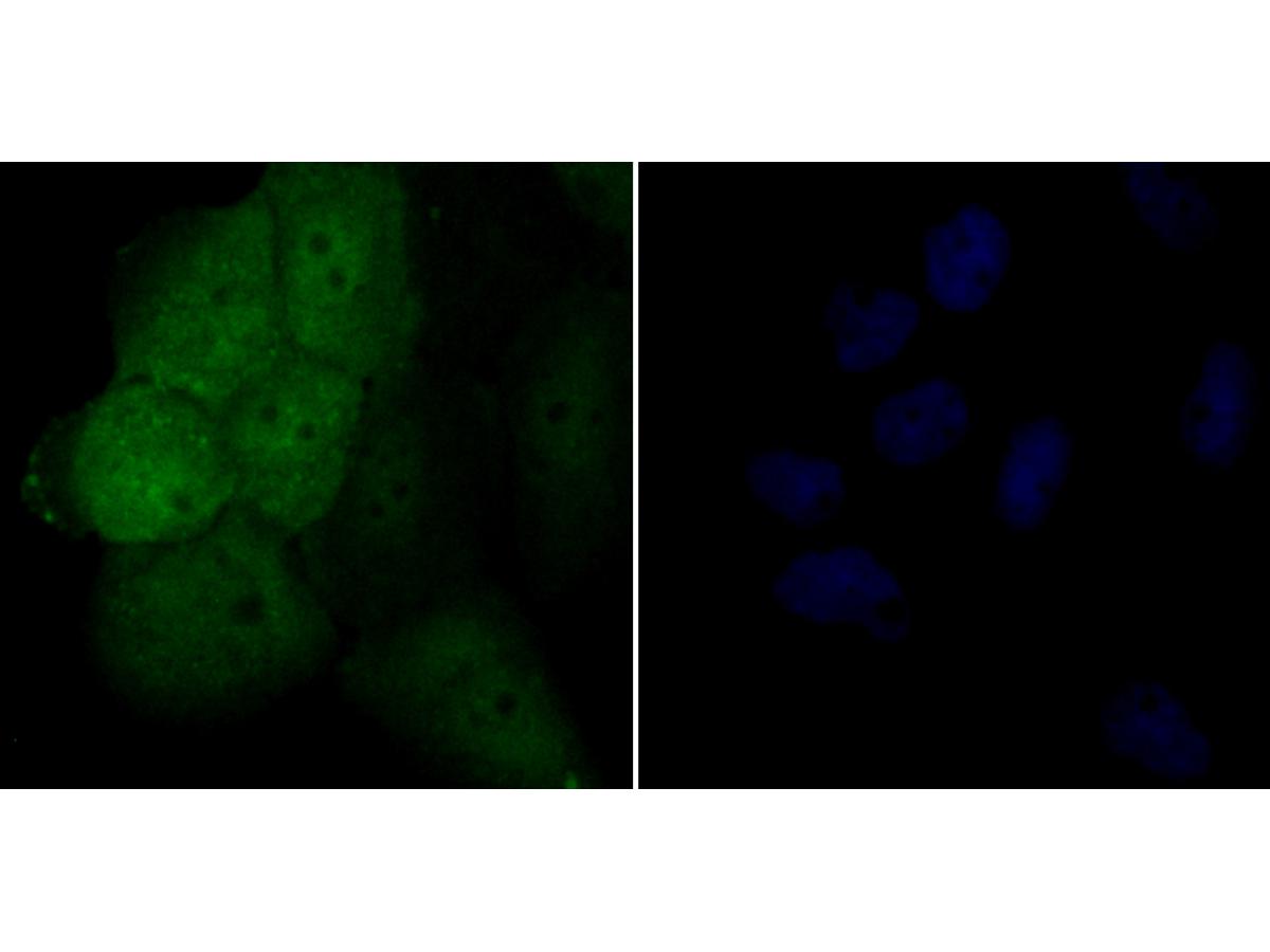 ICC staining Galectin 3 in A431 cells (green). Formalin fixed cells were permeabilized with 0.1% Triton X-100 in TBS for 10 minutes at room temperature and blocked with 1% Blocker BSA for 15 minutes at room temperature. Cells were probed with the antibody (ER1803-82) at a dilution of 1:50 for 1 hour at room temperature, washed with PBS. Alexa Fluorc™ 488 Goat anti-Rabbit IgG was used as the secondary antibody at 1/100 dilution. The nuclear counter stain is DAPI (blue).