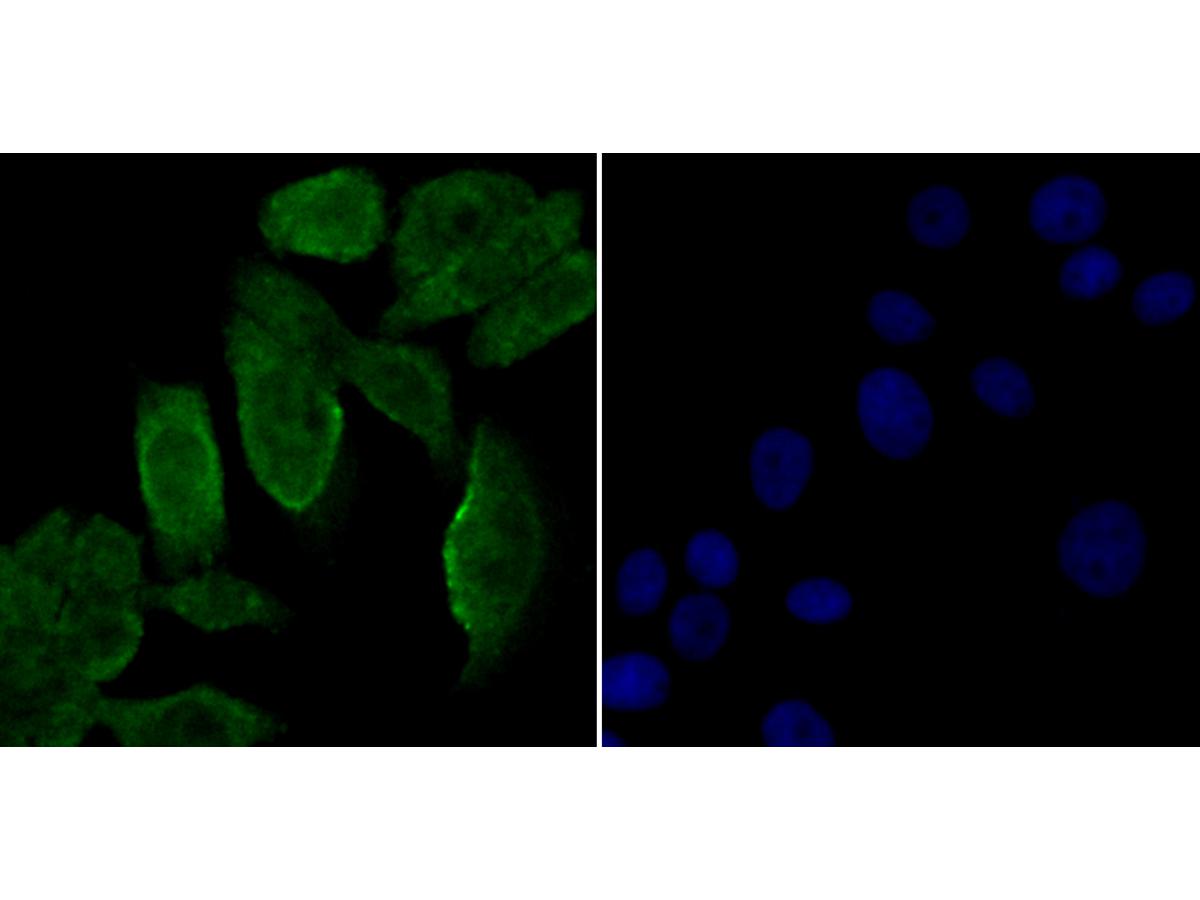 ICC staining Galectin 3 in LOVO cells (green). Formalin fixed cells were permeabilized with 0.1% Triton X-100 in TBS for 10 minutes at room temperature and blocked with 1% Blocker BSA for 15 minutes at room temperature. Cells were probed with the antibody (ER1803-82) at a dilution of 1:100 for 1 hour at room temperature, washed with PBS. Alexa Fluorc™ 488 Goat anti-Rabbit IgG was used as the secondary antibody at 1/100 dilution. The nuclear counter stain is DAPI (blue).