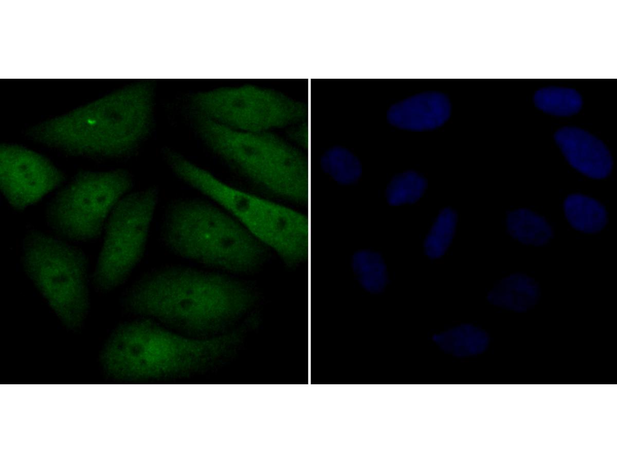 ICC staining Galectin 3 in SiHa cells (green). Formalin fixed cells were permeabilized with 0.1% Triton X-100 in TBS for 10 minutes at room temperature and blocked with 1% Blocker BSA for 15 minutes at room temperature. Cells were probed with the antibody (ER1803-82) at a dilution of 1:100 for 1 hour at room temperature, washed with PBS. Alexa Fluorc™ 488 Goat anti-Rabbit IgG was used as the secondary antibody at 1/100 dilution. The nuclear counter stain is DAPI (blue).