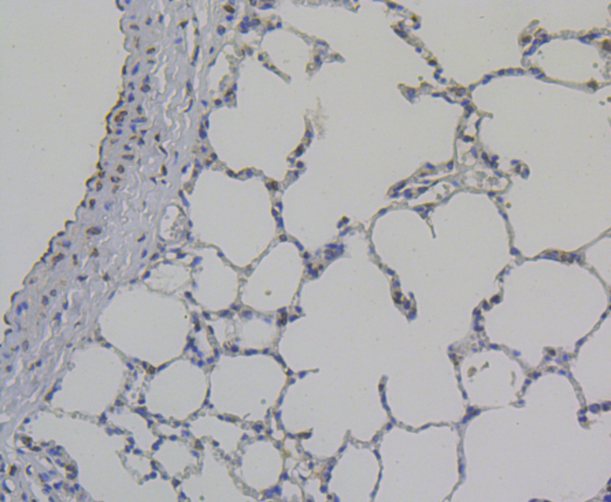 Immunohistochemical analysis of paraffin-embedded rat lung tissue using anti-Galectin 3 antibody. The section was pre-treated using heat mediated antigen retrieval with Tris-EDTA buffer (pH 8.0-8.4) for 20 minutes.The tissues were blocked in 5% BSA for 30 minutes at room temperature, washed with ddH2O and PBS, and then probed with the antibody (ER1803-82) at 1/200 dilution, for 30 minutes at room temperature and detected using an HRP conjugated compact polymer system. DAB was used as the chrogen. Counter stained with hematoxylin and mounted with DPX.