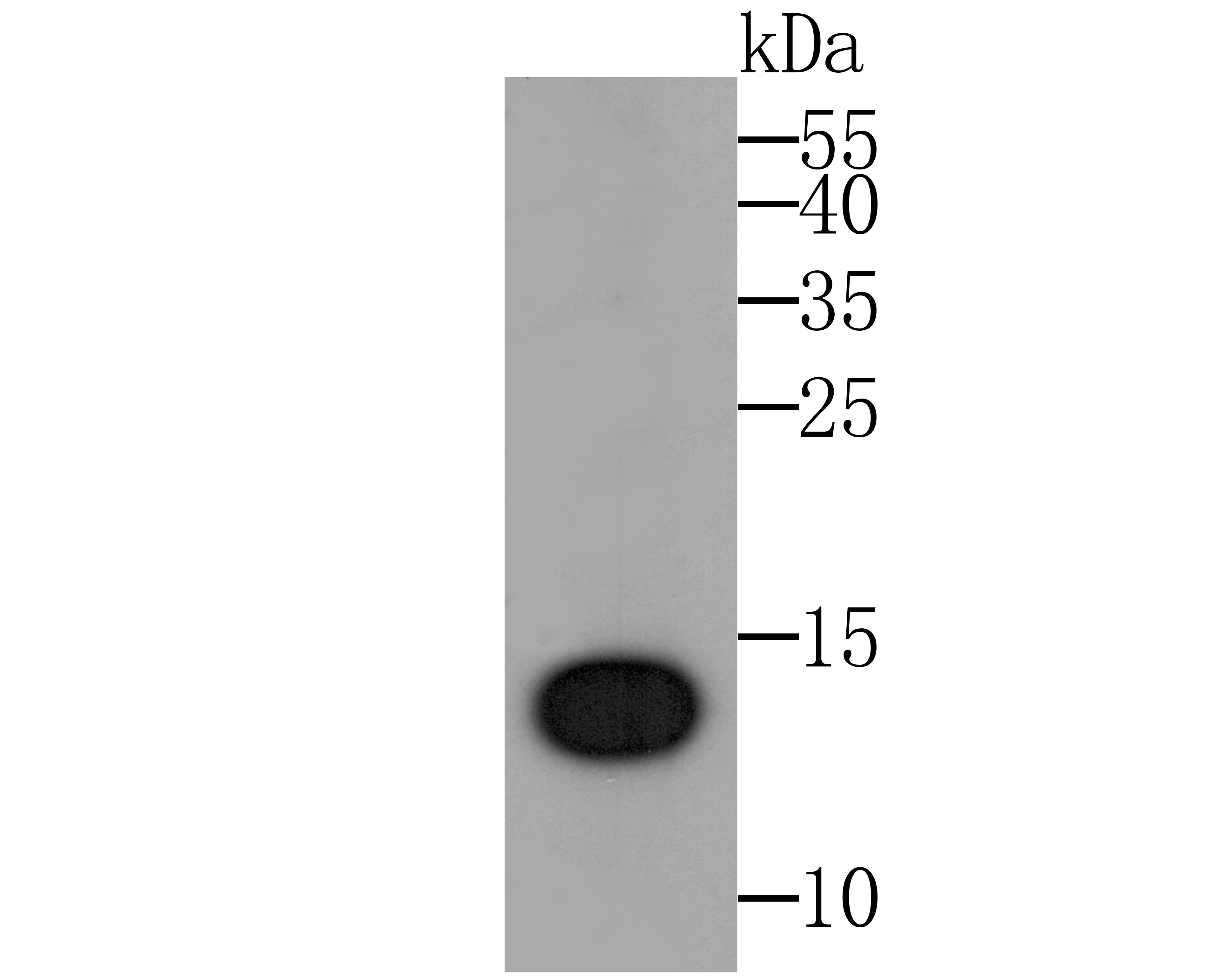 Western blot analysis of IL-22 on IL22  recombinant protein. Proteins were transferred to a PVDF membrane and blocked with 5% BSA in PBS for 1 hour at room temperature. The primary antibody was used at a 1:500 dilution in 5% BSA at room temperature for 2 hours. Goat Anti-Rabbit IgG - HRP Secondary Antibody (HA1001) at 1:5,000 dilution was used for 1 hour at room temperature.