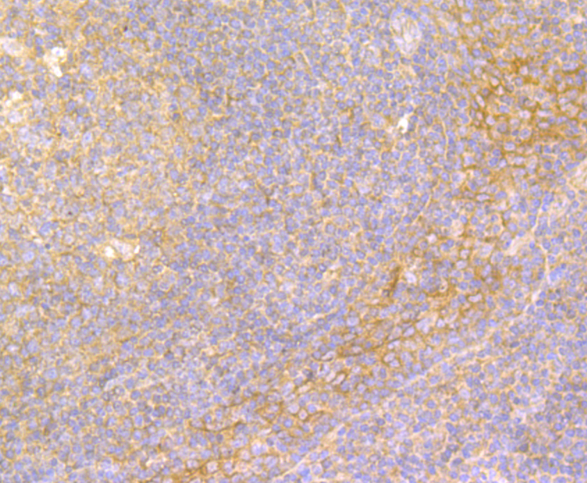 Immunohistochemical analysis of paraffin-embedded human tonsil tissue using anti-IL-22 antibody. The section was pre-treated using heat mediated antigen retrieval with sodium citrate buffer (pH 6.0) for 20 minutes. The tissues were blocked in 5% BSA for 30 minutes at room temperature, washed with ddH2O and PBS, and then probed with the antibody (ER1803-85) at 1/200 dilution, for 30 minutes at room temperature and detected using an HRP conjugated compact polymer system. DAB was used as the chrogen. Counter stained with hematoxylin and mounted with DPX.