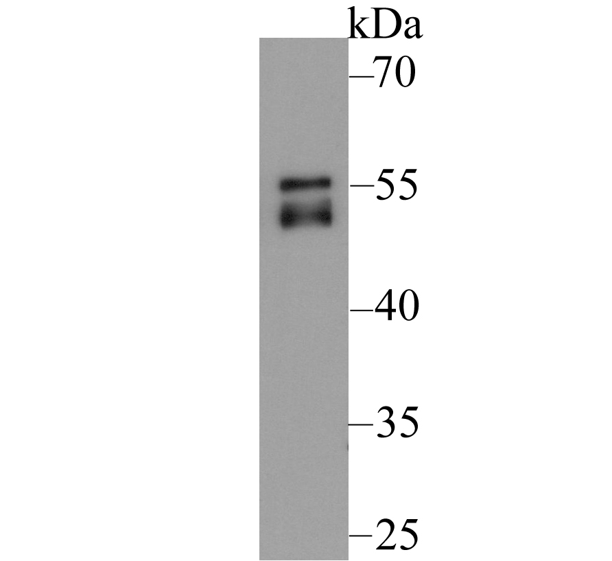 Western blot analysis of Cytokeratin 8 on K562 lysate. Proteins were transferred to a PVDF membrane and blocked with 5% BSA in PBS for 1 hour at room temperature. The primary antibody was used at a 1:2,000 dilution in 5% BSA at room temperature for 2 hours. Goat Anti-Rabbit IgG - HRP Secondary Antibody (HA1001) at 1:5,000 dilution was used for 1 hour at room temperature.