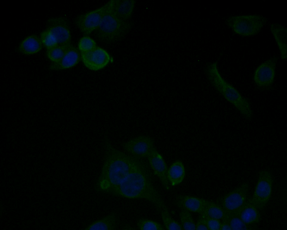 ICC staining Cytokeratin 8 in LOVO cells (green). Formalin fixed cells were permeabilized with 0.1% Triton X-100 in TBS for 10 minutes at room temperature and blocked with 1% Blocker BSA for 15 minutes at room temperature. Cells were probed with Cytokeratin 8 at a dilution of 1:50 for 1 hour at room temperature, washed with PBS. Alexa Fluorc™ 488 Goat anti-Rabbit IgG was used as the secondary antibody at 1/100 dilution. The nuclear counter stain is DAPI (blue).