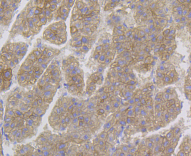 Immunohistochemical analysis of paraffin-embedded human liver tissue using anti-Cytokeratin 8 antibody. The section was pre-treated using heat mediated antigen retrieval with Tris-EDTA buffer (pH 8.0-8.4) for 20 minutes.The tissues were blocked in 5% BSA for 30 minutes at room temperature, washed with ddH2O and PBS, and then probed with the antibody (ER1803-87) at 1/50 dilution, for 30 minutes at room temperature and detected using an HRP conjugated compact polymer system. DAB was used as the chromogen. Counter stained with hematoxylin and mounted with DPX.