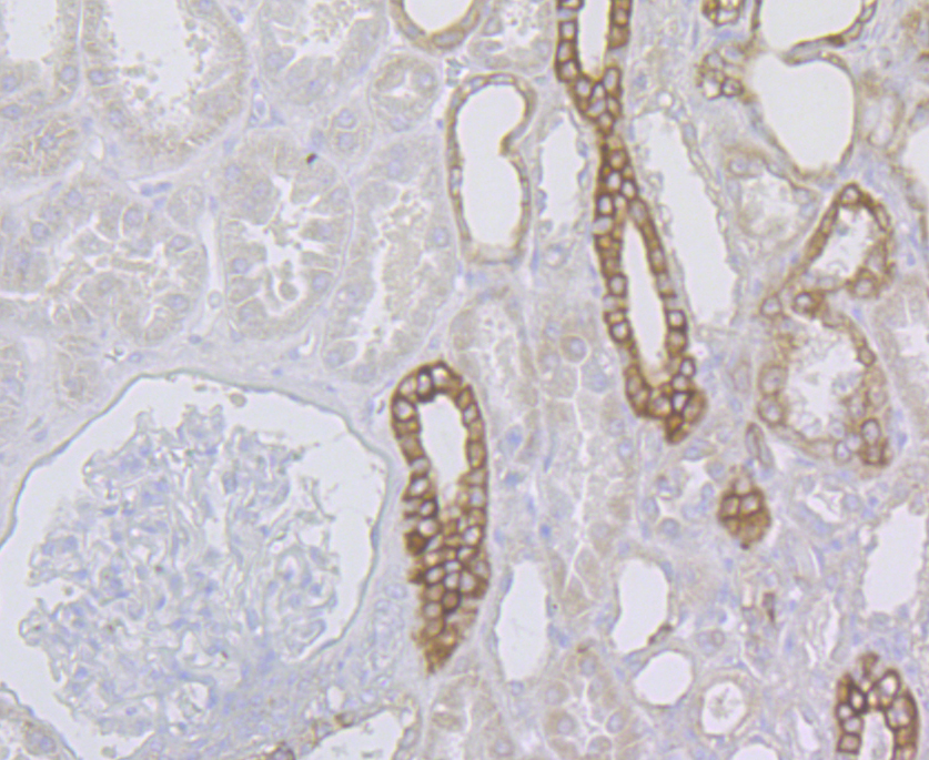 Immunohistochemical analysis of paraffin-embedded human kidney tissue using anti-Cytokeratin 8 antibody. The section was pre-treated using heat mediated antigen retrieval with Tris-EDTA buffer (pH 8.0-8.4) for 20 minutes.The tissues were blocked in 5% BSA for 30 minutes at room temperature, washed with ddH2O and PBS, and then probed with the antibody (ER1803-87) at 1/200 dilution, for 30 minutes at room temperature and detected using an HRP conjugated compact polymer system. DAB was used as the chromogen. Counter stained with hematoxylin and mounted with DPX.