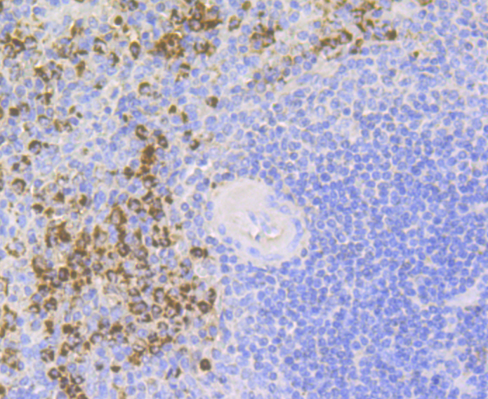 Immunohistochemical analysis of paraffin-embedded human spleen tissue using anti-Lysozyme antibody. The section was pre-treated using heat mediated antigen retrieval with Tris-EDTA buffer (pH 8.0-8.4) for 20 minutes.The tissues were blocked in 5% BSA for 30 minutes at room temperature, washed with ddH2O and PBS, and then probed with the antibody (ER1803-88) at 1/200 dilution, for 30 minutes at room temperature and detected using an HRP conjugated compact polymer system. DAB was used as the chromogen. Counter stained with hematoxylin and mounted with DPX.