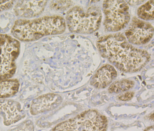 Immunohistochemical analysis of paraffin-embedded human kidney tissue using anti-Lysozyme antibody. The section was pre-treated using heat mediated antigen retrieval with Tris-EDTA buffer (pH 8.0-8.4) for 20 minutes.The tissues were blocked in 5% BSA for 30 minutes at room temperature, washed with ddH2O and PBS, and then probed with the antibody (ER1803-88) at 1/200 dilution, for 30 minutes at room temperature and detected using an HRP conjugated compact polymer system. DAB was used as the chromogen. Counter stained with hematoxylin and mounted with DPX.