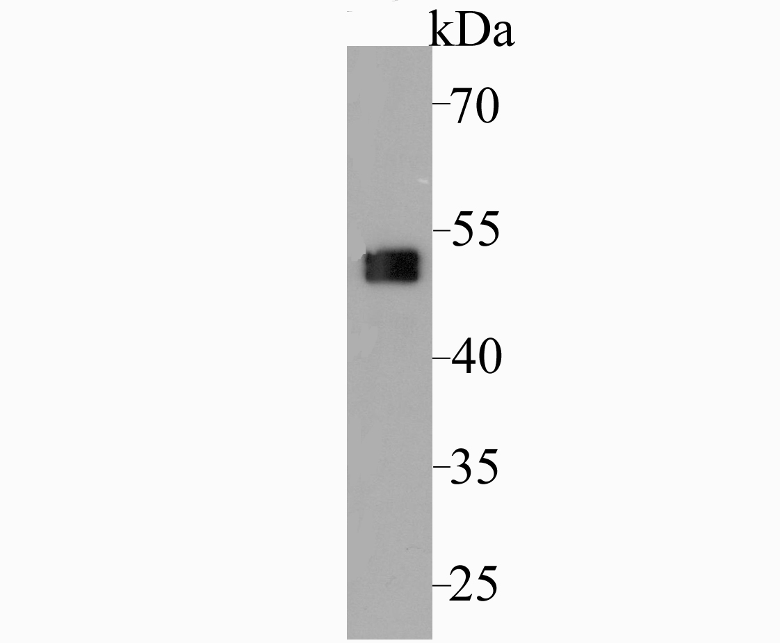 Western blot analysis of Cytokeratin 7 on SK-Br-3 cell lysate. Proteins were transferred to a PVDF membrane and blocked with 5% BSA in PBS for 1 hour at room temperature. The primary antibody was used at a 1:5,000 dilution in 5% BSA at room temperature for 2 hours. Goat Anti-Rabbit IgG - HRP Secondary Antibody (HA1001) at 1:5,000 dilution was used for 1 hour at room temperature.