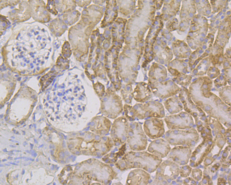Immunohistochemical analysis of paraffin-embedded mouse kidney tissue using anti-Cytokeratin 7 antibody. The section was pre-treated using heat mediated antigen retrieval with Tris-EDTA buffer (pH 8.0-8.4) for 20 minutes.The tissues were blocked in 5% BSA for 30 minutes at room temperature, washed with ddH2O and PBS, and then probed with the antibody (ER1803-89) at 1/200 dilution, for 30 minutes at room temperature and detected using an HRP conjugated compact polymer system. DAB was used as the chromogen. Counter stained with hematoxylin and mounted with DPX.