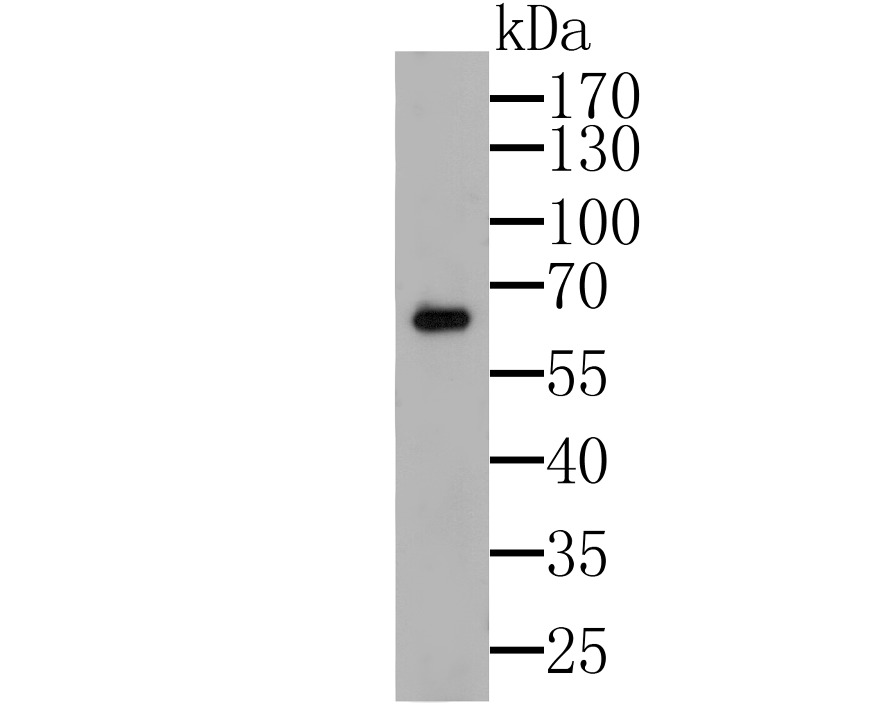 Western blot analysis of G-protein coupled receptor 30 on Lovo cell lysate. Proteins were transferred to a PVDF membrane and blocked with 5% BSA in PBS for 1 hour at room temperature. The primary antibody was used at a 1:500 dilution in 5% BSA at room temperature for 2 hours. Goat Anti-Rabbit IgG - HRP Secondary Antibody (HA1001) at 1:5,000 dilution was used for 1 hour at room temperature.