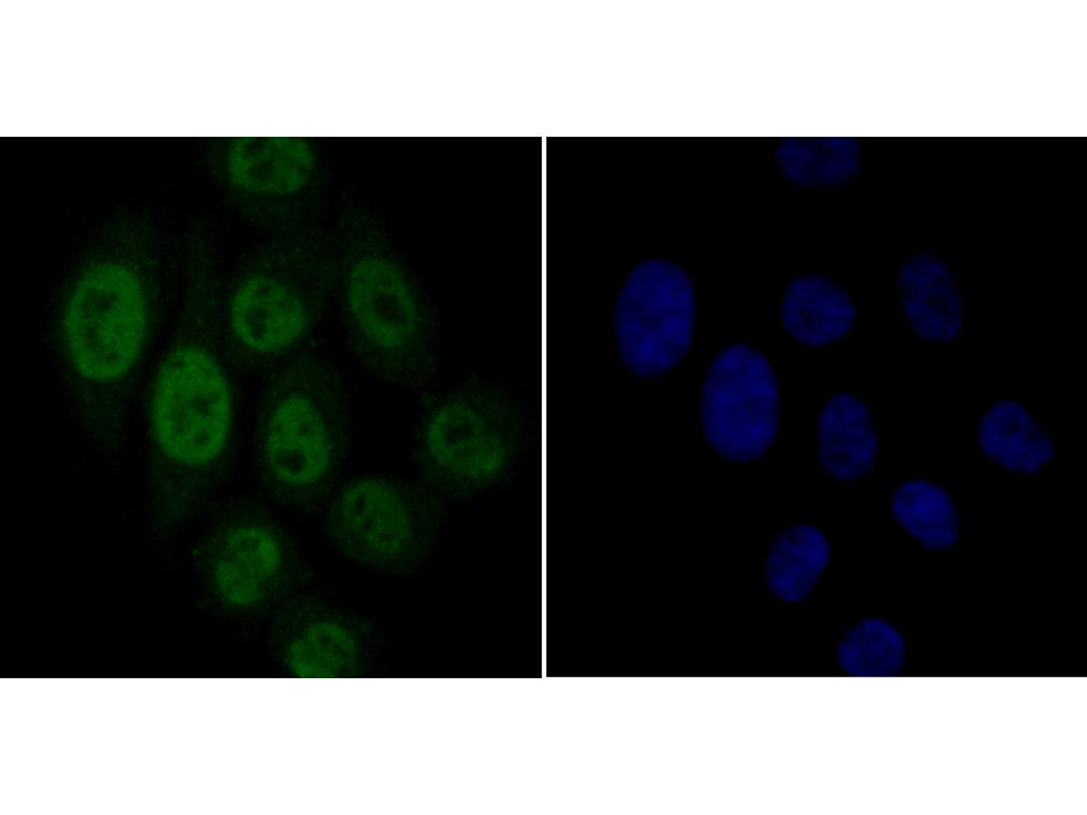 ICC staining G-protein coupled receptor 30 in HepG2 cells (green). Formalin fixed cells were permeabilized with 0.1% Triton X-100 in TBS for 10 minutes at room temperature and blocked with 1% Blocker BSA for 15 minutes at room temperature. Cells were probed with the antibody (ER1803-90) at a dilution of 1:50 for 1 hour at room temperature, washed with PBS. Alexa Fluorc™ 488 Goat anti-Rabbit IgG was used as the secondary antibody at 1/100 dilution. The nuclear counter stain is DAPI (blue).