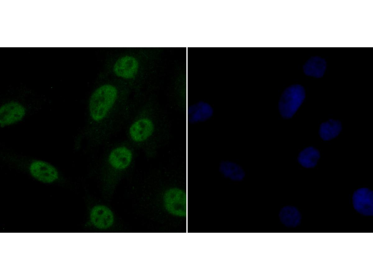 ICC staining G-protein coupled receptor 30 in MG-63 cells (green). Formalin fixed cells were permeabilized with 0.1% Triton X-100 in TBS for 10 minutes at room temperature and blocked with 1% Blocker BSA for 15 minutes at room temperature. Cells were probed with the antibody (ER1803-90) at a dilution of 1:50 for 1 hour at room temperature, washed with PBS. Alexa Fluorc™ 488 Goat anti-Rabbit IgG was used as the secondary antibody at 1/100 dilution. The nuclear counter stain is DAPI (blue).