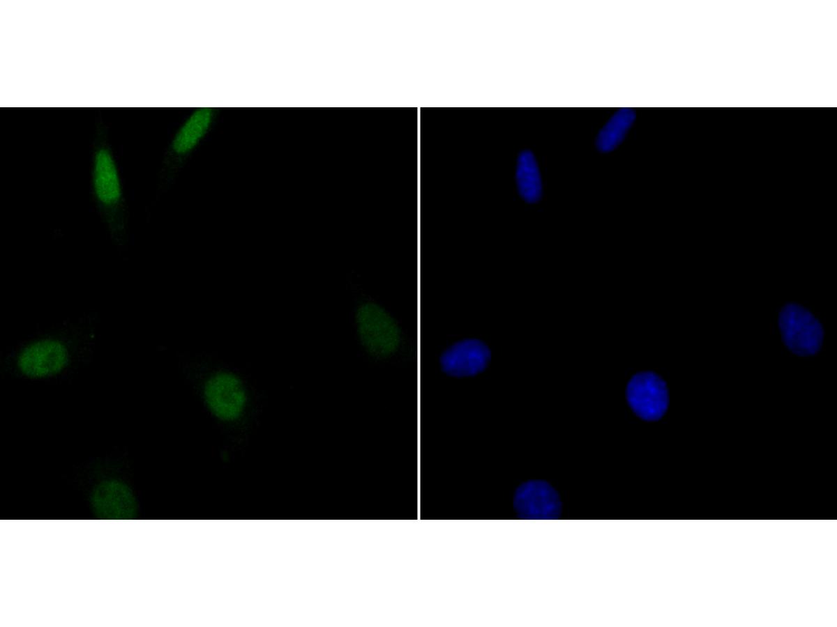 ICC staining G-protein coupled receptor 30 in SH-SY-5Y cells (green). Formalin fixed cells were permeabilized with 0.1% Triton X-100 in TBS for 10 minutes at room temperature and blocked with 1% Blocker BSA for 15 minutes at room temperature. Cells were probed with the antibody (ER1803-90) at a dilution of 1:100 for 1 hour at room temperature, washed with PBS. Alexa Fluorc™ 488 Goat anti-Rabbit IgG was used as the secondary antibody at 1/100 dilution. The nuclear counter stain is DAPI (blue).