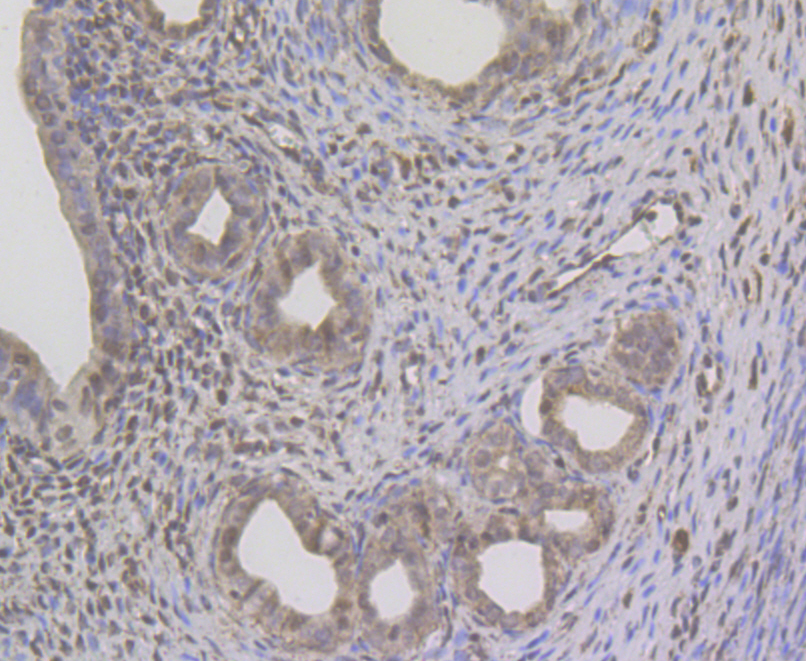 Immunohistochemical analysis of paraffin-embedded rat uterus tissue using anti-G-protein coupled receptor 30 antibody. The section was pre-treated using heat mediated antigen retrieval with Tris-EDTA buffer (pH 8.0-8.4) for 20 minutes.The tissues were blocked in 5% BSA for 30 minutes at room temperature, washed with ddH2O and PBS, and then probed with the antibody (ER1803-90) at 1/200 dilution, for 30 minutes at room temperature and detected using an HRP conjugated compact polymer system. DAB was used as the chrogen. Counter stained with hematoxylin and mounted with DPX.