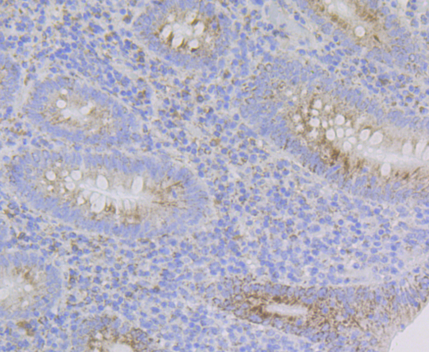 Immunohistochemical analysis of paraffin-embedded human appendix tissue using anti-G-protein coupled receptor 30 antibody. The section was pre-treated using heat mediated antigen retrieval with Tris-EDTA buffer (pH 8.0-8.4) for 20 minutes.The tissues were blocked in 5% BSA for 30 minutes at room temperature, washed with ddH2O and PBS, and then probed with the antibody (ER1803-90) at 1/200 dilution, for 30 minutes at room temperature and detected using an HRP conjugated compact polymer system. DAB was used as the chrogen. Counter stained with hematoxylin and mounted with DPX.
