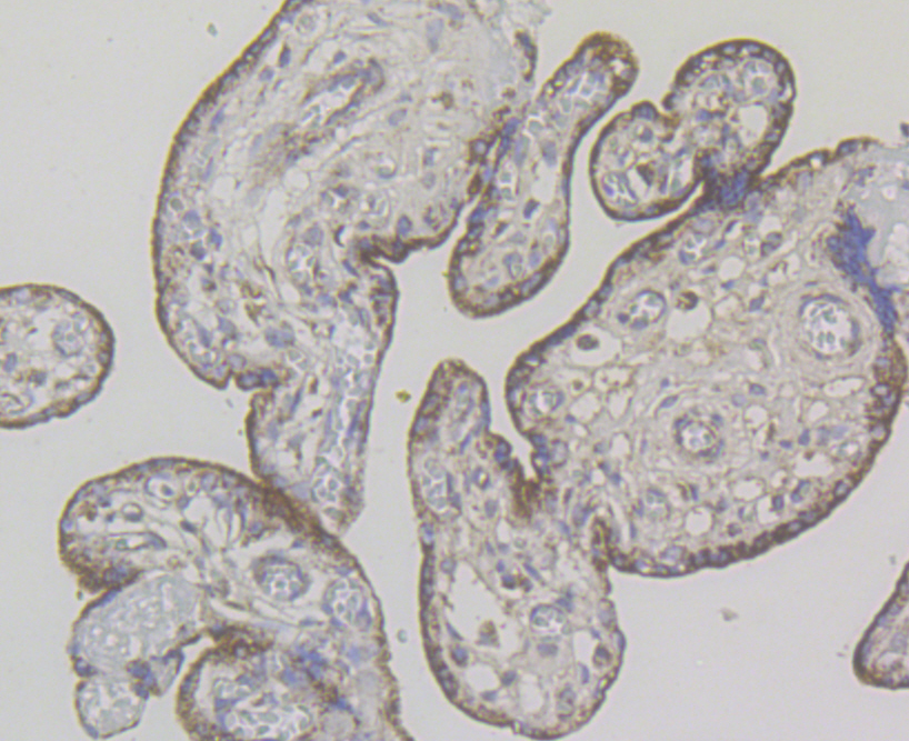 Immunohistochemical analysis of paraffin-embedded human placenta tissue using anti-G-protein coupled receptor 30 antibody. The section was pre-treated using heat mediated antigen retrieval with Tris-EDTA buffer (pH 8.0-8.4) for 20 minutes.The tissues were blocked in 5% BSA for 30 minutes at room temperature, washed with ddH2O and PBS, and then probed with the antibody (ER1803-90) at 1/200 dilution, for 30 minutes at room temperature and detected using an HRP conjugated compact polymer system. DAB was used as the chrogen. Counter stained with hematoxylin and mounted with DPX.