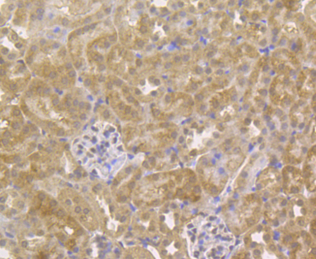 Immunohistochemical analysis of paraffin-embedded mouse kidney tissue using anti-G-protein coupled receptor 30 antibody. The section was pre-treated using heat mediated antigen retrieval with Tris-EDTA buffer (pH 8.0-8.4) for 20 minutes.The tissues were blocked in 5% BSA for 30 minutes at room temperature, washed with ddH2O and PBS, and then probed with the antibody (ER1803-90) at 1/200 dilution, for 30 minutes at room temperature and detected using an HRP conjugated compact polymer system. DAB was used as the chrogen. Counter stained with hematoxylin and mounted with DPX.