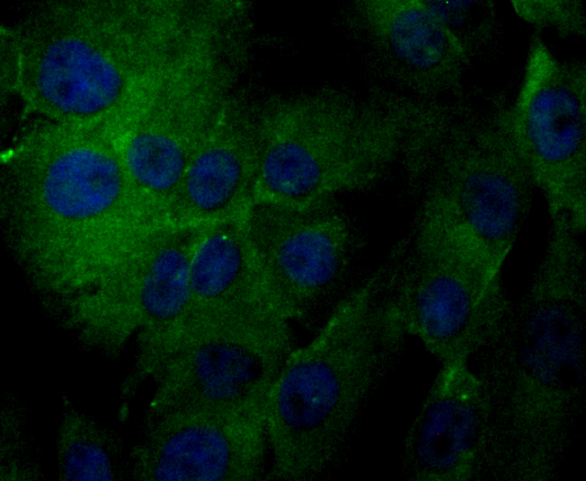 ICC staining TRPA1 in MG-63 cells (green). Formalin fixed cells were permeabilized with 0.1% Triton X-100 in TBS for 10 minutes at room temperature and blocked with 1% Blocker BSA for 15 minutes at room temperature. Cells were probed with the antibody (ER1803-91) at a dilution of 1:50 for 1 hour at room temperature, washed with PBS. Alexa Fluorc™ 488 Goat anti-Rabbit IgG was used as the secondary antibody at 1/100 dilution. The nuclear counter stain is DAPI (blue).