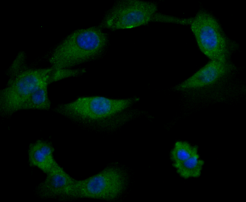 ICC staining TRPA1 in NIH-3T3 cells (green). Formalin fixed cells were permeabilized with 0.1% Triton X-100 in TBS for 10 minutes at room temperature and blocked with 1% Blocker BSA for 15 minutes at room temperature. Cells were probed with the antibody (ER1803-91) at a dilution of 1:100 for 1 hour at room temperature, washed with PBS. Alexa Fluorc™ 488 Goat anti-Rabbit IgG was used as the secondary antibody at 1/100 dilution. The nuclear counter stain is DAPI (blue).
