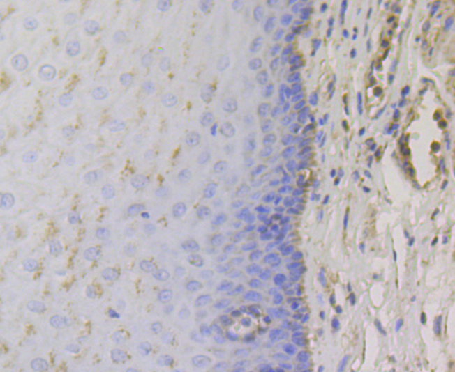 Immunohistochemical analysis of paraffin-embedded human esophagus tissue using anti-TRPA1 antibody. The section was pre-treated using heat mediated antigen retrieval with Tris-EDTA buffer (pH 8.0-8.4) for 20 minutes.The tissues were blocked in 5% BSA for 30 minutes at room temperature, washed with ddH2O and PBS, and then probed with the antibody (ER1803-91) at 1/200 dilution, for 30 minutes at room temperature and detected using an HRP conjugated compact polymer system. DAB was used as the chrogen. Counter stained with hematoxylin and mounted with DPX.