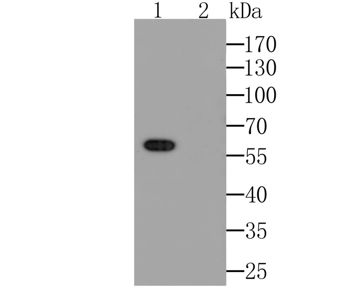 Western blot analysis of Connexin 45 / GJA7 / Cx45 on SH-SY5Y cell lysate. Proteins were transferred to a PVDF membrane and blocked with 5% BSA in PBS for 1 hour at room temperature. The primary antibody was used at a 1:1,000 dilution in 5% BSA at room temperature for 2 hours. Goat Anti-Rabbit IgG - HRP Secondary Antibody (HA1001) at 1:5,000 dilution was used for 1 hour at room temperature.<br />
<br />
Lane 1: Anti-Connexin-45 Antibody;<br />
Lane 2: Anti-Connexin-45 Antibody, pre-incubated with the <br />
immunizaiton peptide.