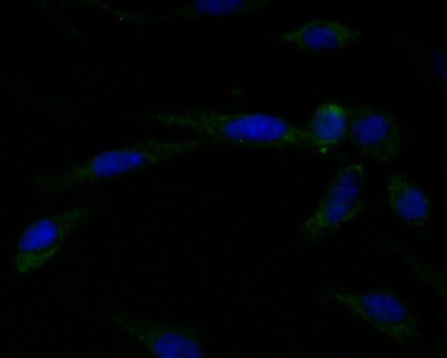 ICC staining Connexin 45 in SH-SY5Y cells (green). Formalin fixed cells were permeabilized with 0.1% Triton X-100 in TBS for 10 minutes at room temperature and blocked with 1% Blocker BSA for 15 minutes at room temperature. Cells were probed with Connexin 45 antibody at a dilution of 1:100 for 1 hour at room temperature, washed with PBS. Alexa Fluorc™ 488 Goat anti-Mouse IgG was used as the secondary antibody at 1/100 dilution. The nuclear counter stain is DAPI (blue).