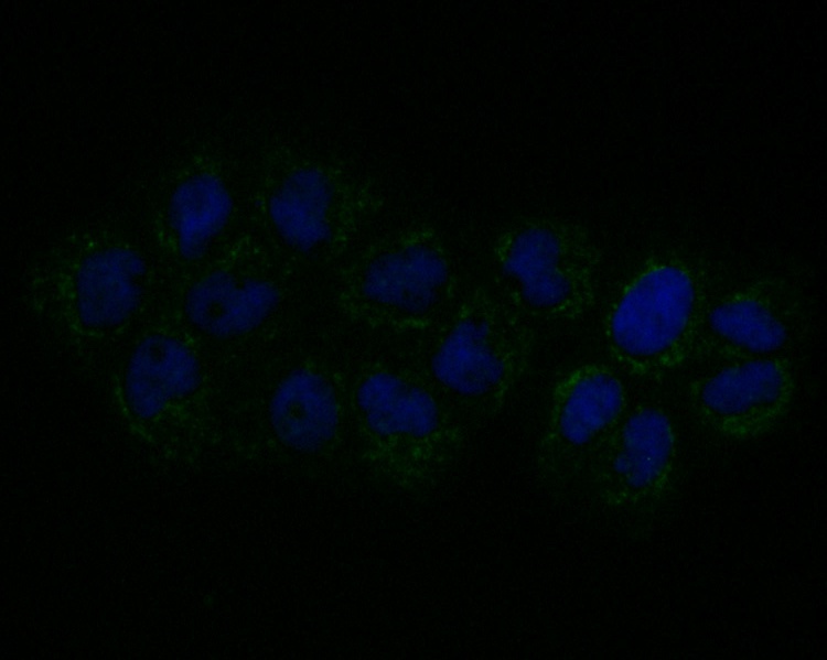 ICC staining Connexin 45 in A431 cells (green). Formalin fixed cells were permeabilized with 0.1% Triton X-100 in TBS for 10 minutes at room temperature and blocked with 1% Blocker BSA for 15 minutes at room temperature. Cells were probed with Connexin 45 antibody at a dilution of 1:100 for 1 hour at room temperature, washed with PBS. Alexa Fluorc™ 488 Goat anti-Mouse IgG was used as the secondary antibody at 1/100 dilution. The nuclear counter stain is DAPI (blue).