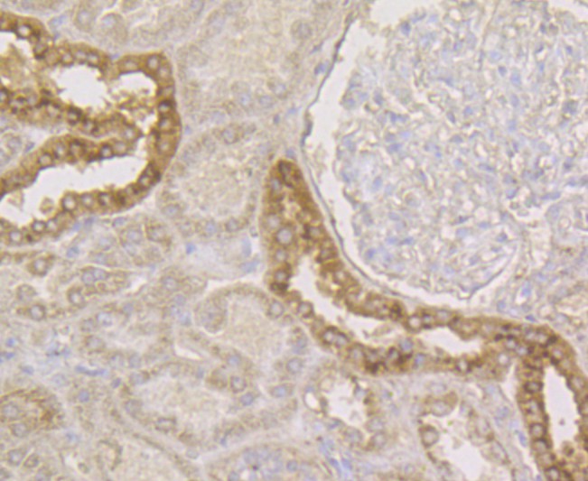 Immunohistochemical analysis of paraffin-embedded human kidney tissue using anti-Connexin 45 / GJA7 / Cx45 antibody. The section was pre-treated using heat mediated antigen retrieval with Tris-EDTA buffer (pH 8.0-8.4) for 20 minutes.The tissues were blocked in 5% BSA for 30 minutes at room temperature, washed with ddH2O and PBS, and then probed with the antibody (ER1803-93) at 1/50 dilution, for 30 minutes at room temperature and detected using an HRP conjugated compact polymer system. DAB was used as the chromogen. Counter stained with hematoxylin and mounted with DPX.