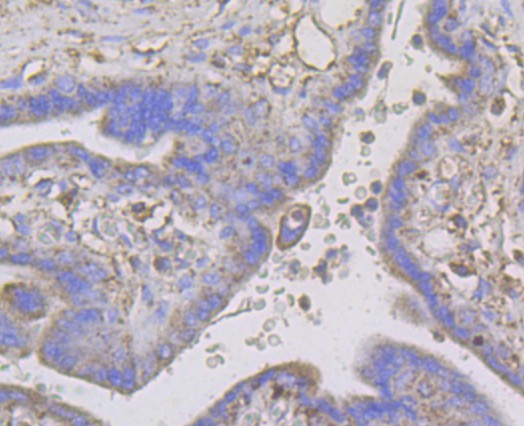 Immunohistochemical analysis of paraffin-embedded human placenta tissue using anti-Connexin 45 / GJA7 / Cx45 antibody. The section was pre-treated using heat mediated antigen retrieval with Tris-EDTA buffer (pH 8.0-8.4) for 20 minutes.The tissues were blocked in 5% BSA for 30 minutes at room temperature, washed with ddH2O and PBS, and then probed with the antibody (ER1803-93) at 1/50 dilution, for 30 minutes at room temperature and detected using an HRP conjugated compact polymer system. DAB was used as the chromogen. Counter stained with hematoxylin and mounted with DPX.