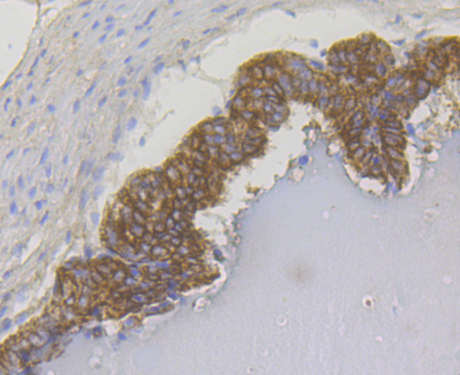 Immunohistochemical analysis of paraffin-embedded rat prostate tissue using anti-Cytokeratin 17 antibody. The section was pre-treated using heat mediated antigen retrieval with Tris-EDTA buffer (pH 8.0-8.4) for 20 minutes.The tissues were blocked in 5% BSA for 30 minutes at room temperature, washed with ddH2O and PBS, and then probed with the antibody (ER1803-94) at 1/50 dilution, for 30 minutes at room temperature and detected using an HRP conjugated compact polymer system. DAB was used as the Chromogen. Counter stained with hematoxylin and mounted with DPX.