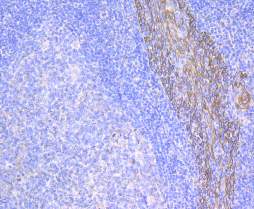 Immunohistochemical analysis of paraffin-embedded human tonsil tissue using anti-Cytokeratin 17 antibody. The section was pre-treated using heat mediated antigen retrieval with Tris-EDTA buffer (pH 8.0-8.4) for 20 minutes.The tissues were blocked in 5% BSA for 30 minutes at room temperature, washed with ddH2O and PBS, and then probed with the antibody (ER1803-94) at 1/50 dilution, for 30 minutes at room temperature and detected using an HRP conjugated compact polymer system. DAB was used as the Chromogen. Counter stained with hematoxylin and mounted with DPX.