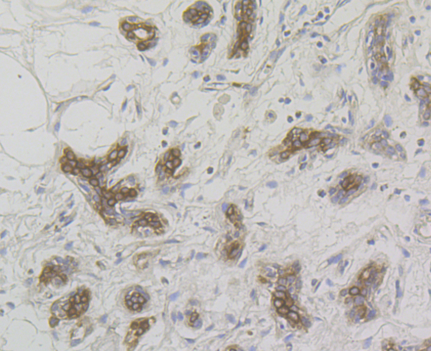 Immunohistochemical analysis of paraffin-embedded human breast tissue using anti-Cytokeratin 17 antibody. The section was pre-treated using heat mediated antigen retrieval with Tris-EDTA buffer (pH 8.0-8.4) for 20 minutes.The tissues were blocked in 5% BSA for 30 minutes at room temperature, washed with ddH2O and PBS, and then probed with the antibody (ER1803-94) at 1/50 dilution, for 30 minutes at room temperature and detected using an HRP conjugated compact polymer system. DAB was used as the Chromogen. Counter stained with hematoxylin and mounted with DPX.
