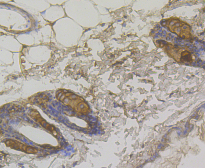 Immunohistochemical analysis of paraffin-embedded mouse skin tissue using anti-Cytokeratin 17 antibody. The section was pre-treated using heat mediated antigen retrieval with Tris-EDTA buffer (pH 8.0-8.4) for 20 minutes.The tissues were blocked in 5% BSA for 30 minutes at room temperature, washed with ddH2O and PBS, and then probed with the antibody (ER1803-94) at 1/50 dilution, for 30 minutes at room temperature and detected using an HRP conjugated compact polymer system. DAB was used as the Chromogen. Counter stained with hematoxylin and mounted with DPX.