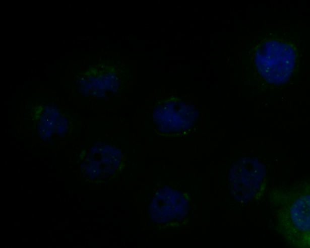ICC staining MICA + MICB in A431 cells (green). Formalin fixed cells were permeabilized with 0.1% Triton X-100 in TBS for 10 minutes at room temperature and blocked with 1% Blocker BSA for 15 minutes at room temperature. Cells were probed with MICA + MICB at a dilution of 1:100 for 1 hour at room temperature, washed with PBS. Alexa Fluorc™ 488 Goat anti-Rabbit IgG was used as the secondary antibody at 1/100 dilution. The nuclear counter stain is DAPI (blue).