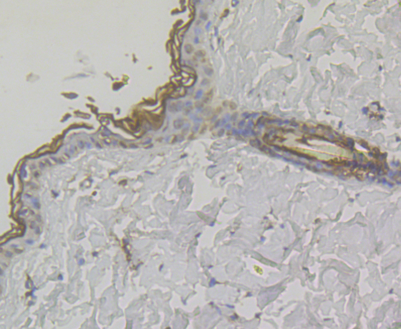Immunohistochemical analysis of paraffin-embedded rat skin tissue using anti-MICA + MICB antibody. The section was pre-treated using heat mediated antigen retrieval with Tris-EDTA buffer (pH 8.0-8.4) for 20 minutes.The tissues were blocked in 5% BSA for 30 minutes at room temperature, washed with ddH2O and PBS, and then probed with the antibody (ER1803-95) at 1/50 dilution, for 30 minutes at room temperature and detected using an HRP conjugated compact polymer system. DAB was used as the chrogen. Counter stained with hematoxylin and mounted with DPX.