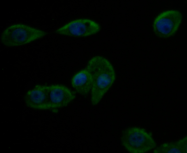 ICC staining of Kir6.2 in LoVo cells (green). Formalin fixed cells were permeabilized with 0.1% Triton X-100 in TBS for 10 minutes at room temperature and blocked with 1% Blocker BSA for 15 minutes at room temperature. Cells were probed with the antibody (ER1803-98) at a dilution of 1:200 for 1 hour at room temperature, washed with PBS. Alexa Fluor®488 Goat anti-Rabbit IgG was used as the secondary antibody at 1/100 dilution. The nuclear counter stain is DAPI (blue).