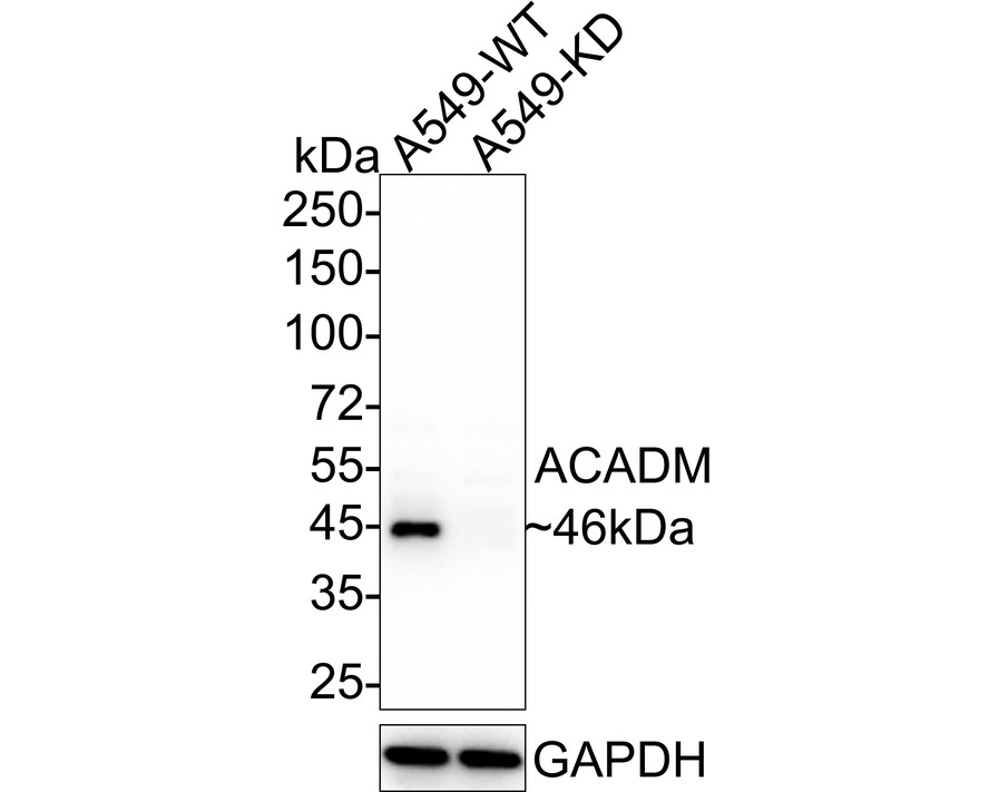 Western blot analysis of ACADM on different lysates. Proteins were transferred to a PVDF membrane and blocked with 5% BSA in PBS for 1 hour at room temperature. The primary antibody (ER1804-01, 1/500) was used in 5% BSA at room temperature for 2 hours. Goat Anti-Rabbit IgG - HRP Secondary Antibody (HA1001) at 1:5,000 dilution was used for 1 hour at room temperature.<br />
Positive control: <br />
Lane 1: Daudi cell lysate<br />
Lane 2: K562 cell lysate