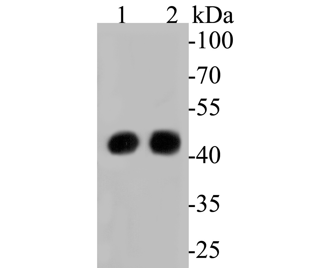ICC staining of ACADM in SH-SY5Y cells (green). Formalin fixed cells were permeabilized with 0.1% Triton X-100 in TBS for 10 minutes at room temperature and blocked with 1% Blocker BSA for 15 minutes at room temperature. Cells were probed with the primary antibody (ER1804-01, 1/200) for 1 hour at room temperature, washed with PBS. Alexa Fluor®488 Goat anti-Rabbit IgG was used as the secondary antibody at 1/1,000 dilution. The nuclear counter stain is DAPI (blue).