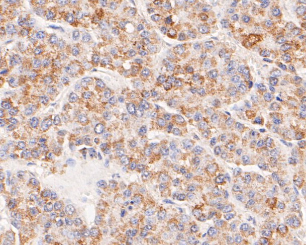Immunohistochemical analysis of paraffin-embedded mouse kidney tissue using anti-ACADM antibody. The section was pre-treated using heat mediated antigen retrieval with Tris-EDTA buffer (pH 8.0-8.4) for 20 minutes.The tissues were blocked in 5% BSA for 30 minutes at room temperature, washed with ddH2O and PBS, and then probed with the primary antibody (ER1804-01, 1/50) for 30 minutes at room temperature. The detection was performed using an HRP conjugated compact polymer system. DAB was used as the chromogen. Tissues were counterstained with hematoxylin and mounted with DPX.