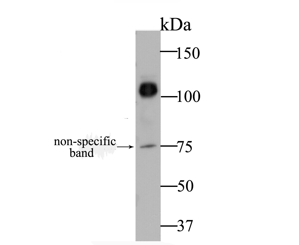 Western blot analysis of CDH17 on human colon tissue lysate. Proteins were transferred to a PVDF membrane and blocked with 5% BSA in PBS for 1 hour at room temperature. The primary antibody was used at a 1:1,000 dilution in 5% BSA at room temperature for 2 hours. Goat Anti-Rabbit IgG - HRP Secondary Antibody (HA1001) at 1:5,000 dilution was used for 1 hour at room temperature.