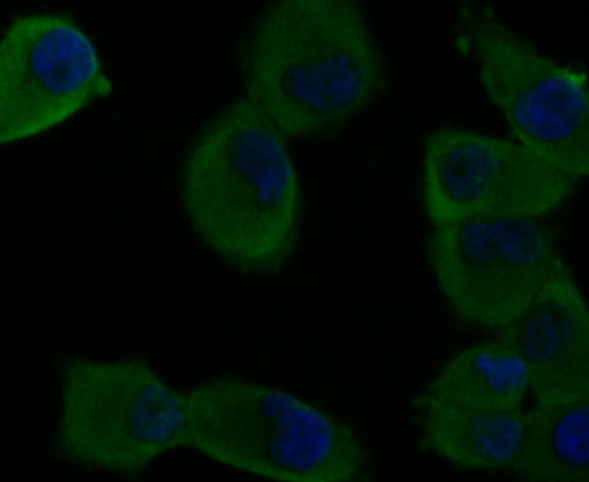 ICC staining of CDH17 in PANC-1 cells (green). Formalin fixed cells were permeabilized with 0.1% Triton X-100 in TBS for 10 minutes at room temperature and blocked with 1% Blocker BSA for 15 minutes at room temperature. Cells were probed with the antibody (ER1804-02) at a dilution of 1:50 for 1 hour at room temperature, washed with PBS. Alexa Fluor®488 Goat anti-Rabbit IgG was used as the secondary antibody at 1/100 dilution. The nuclear counter stain is DAPI (blue).