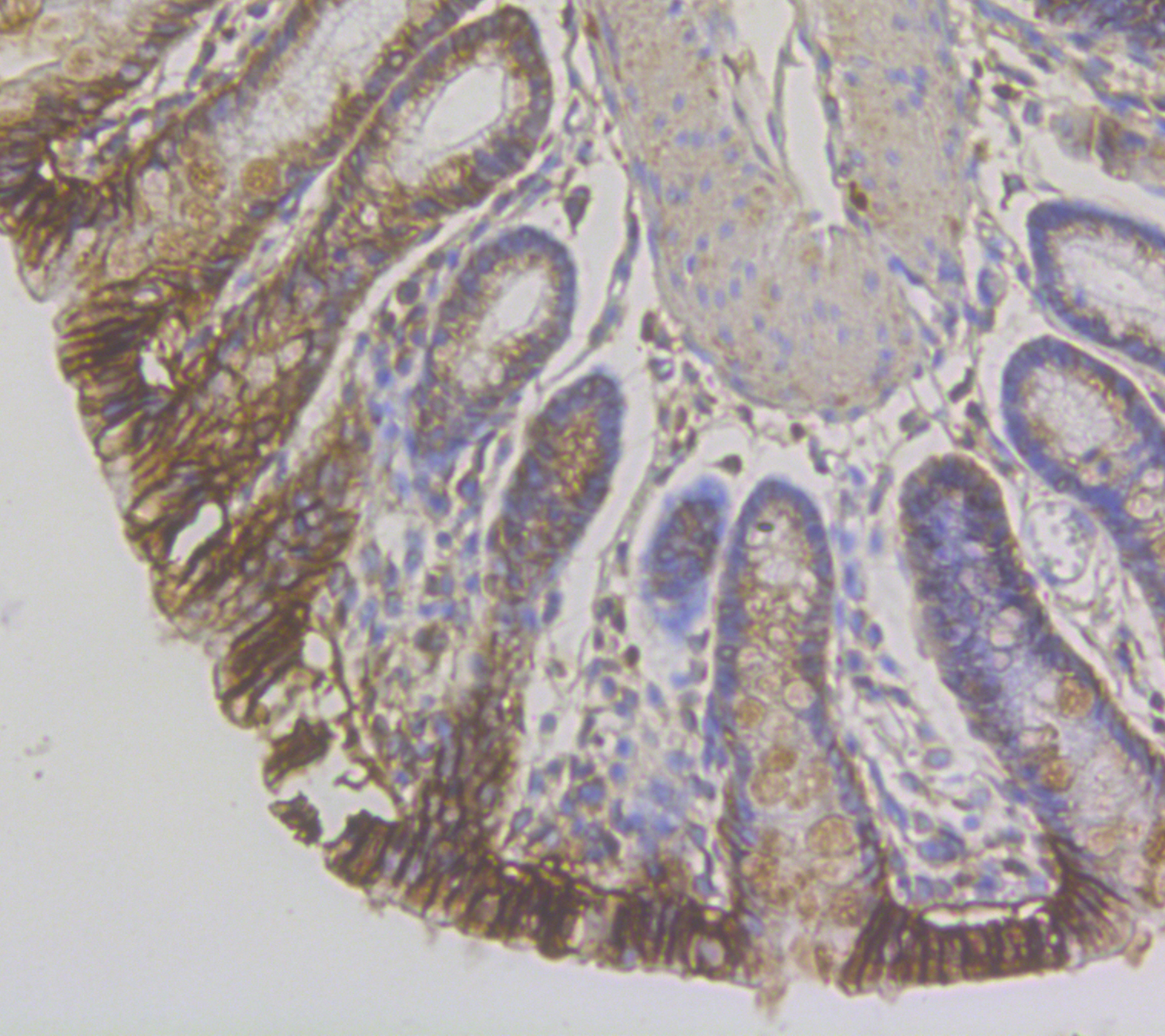 Immunohistochemical analysis of paraffin-embedded rat colon tissue using anti-CDH17 antibody. The section was pre-treated using heat mediated antigen retrieval with Tris-EDTA buffer (pH 8.0-8.4) for 20 minutes.The tissues were blocked in 5% BSA for 30 minutes at room temperature, washed with ddH2O and PBS, and then probed with the antibody (ER1804-02) at 1/50 dilution, for 30 minutes at room temperature and detected using an HRP conjugated compact polymer system. DAB was used as the chromogen. Counter stained with hematoxylin and mounted with DPX.