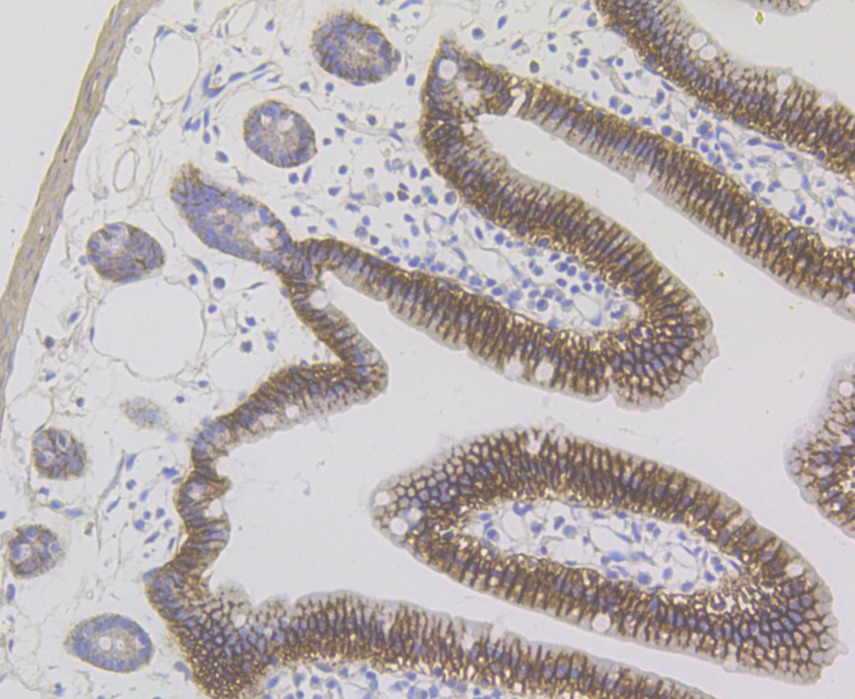 Immunohistochemical analysis of paraffin-embedded mouse small intestine tissue using anti-CDH17 antibody. The section was pre-treated using heat mediated antigen retrieval with Tris-EDTA buffer (pH 8.0-8.4) for 20 minutes.The tissues were blocked in 5% BSA for 30 minutes at room temperature, washed with ddH2O and PBS, and then probed with the antibody (ER1804-02) at 1/200 dilution, for 30 minutes at room temperature and detected using an HRP conjugated compact polymer system. DAB was used as the chromogen. Counter stained with hematoxylin and mounted with DPX.