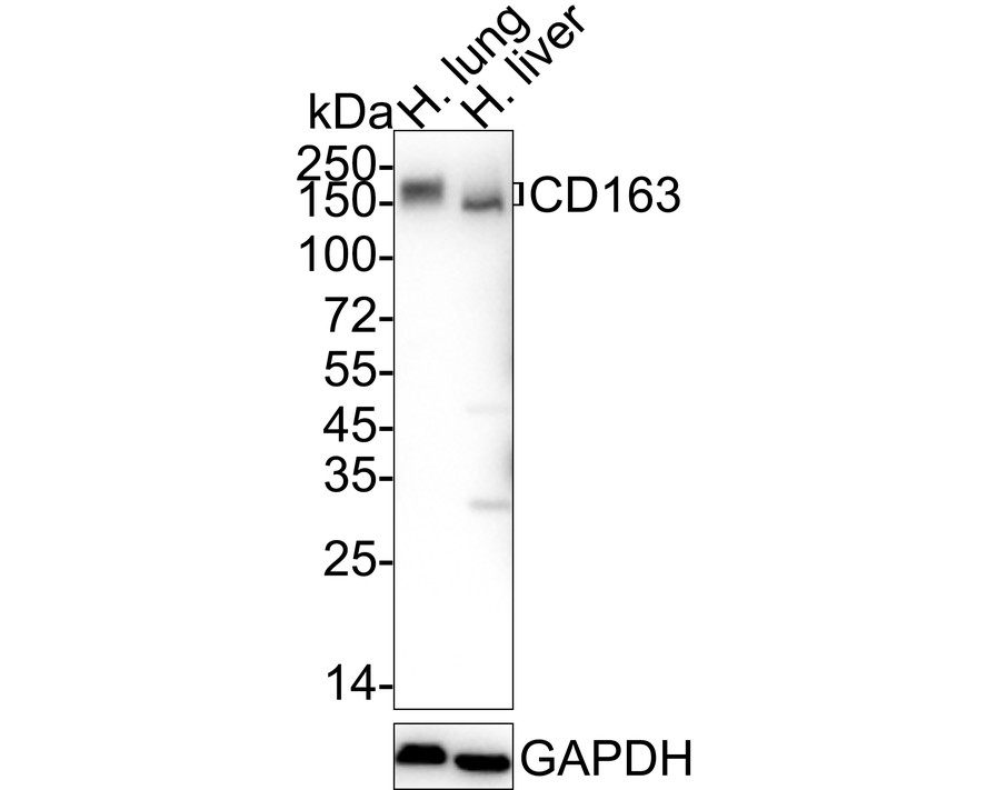 Western blot analysis of CD163 on different lysates. Proteins were transferred to a PVDF membrane and blocked with 5% BSA in PBS for 1 hour at room temperature. The primary antibody was used at a 1:500 dilution in 5% BSA at room temperature for 2 hours. Goat Anti-Rabbit IgG - HRP Secondary Antibody (HA1001) at 1:5,000 dilution was used for 1 hour at room temperature.<br />
Positive control: <br />
Lane 1: Human thymus tissue lysate<br />
Lane 2: Human liver tissue lysate