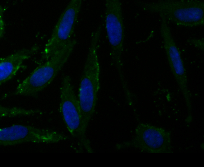 ICC staining of CD163 in SH-SY5Y cells (green). Formalin fixed cells were permeabilized with 0.1% Triton X-100 in TBS for 10 minutes at room temperature and blocked with 1% Blocker BSA for 15 minutes at room temperature. Cells were probed with the antibody (ER1804-03) at a dilution of 1:100 for 1 hour at room temperature, washed with PBS. Alexa Fluor®488 Goat anti-Rabbit IgG was used as the secondary antibody at 1/100 dilution. The nuclear counter stain is DAPI (blue).