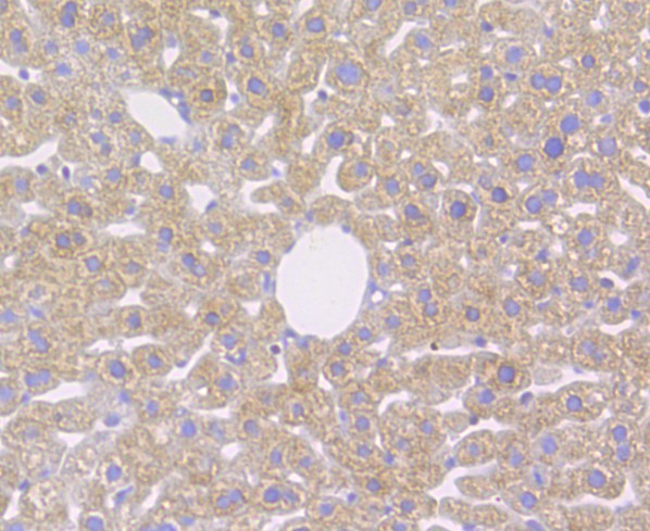 Immunohistochemical analysis of paraffin-embedded mouse liver tissue using anti-CD163 antibody. The section was pre-treated using heat mediated antigen retrieval with Tris-EDTA buffer (pH 8.0-8.4) for 20 minutes.The tissues were blocked in 5% BSA for 30 minutes at room temperature, washed with ddH2O and PBS, and then probed with the antibody (ER1804-03) at 1/200 dilution, for 30 minutes at room temperature and detected using an HRP conjugated compact polymer system. DAB was used as the chromogen. Counter stained with hematoxylin and mounted with DPX..